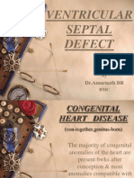 Ventricular Septal Defect Guide