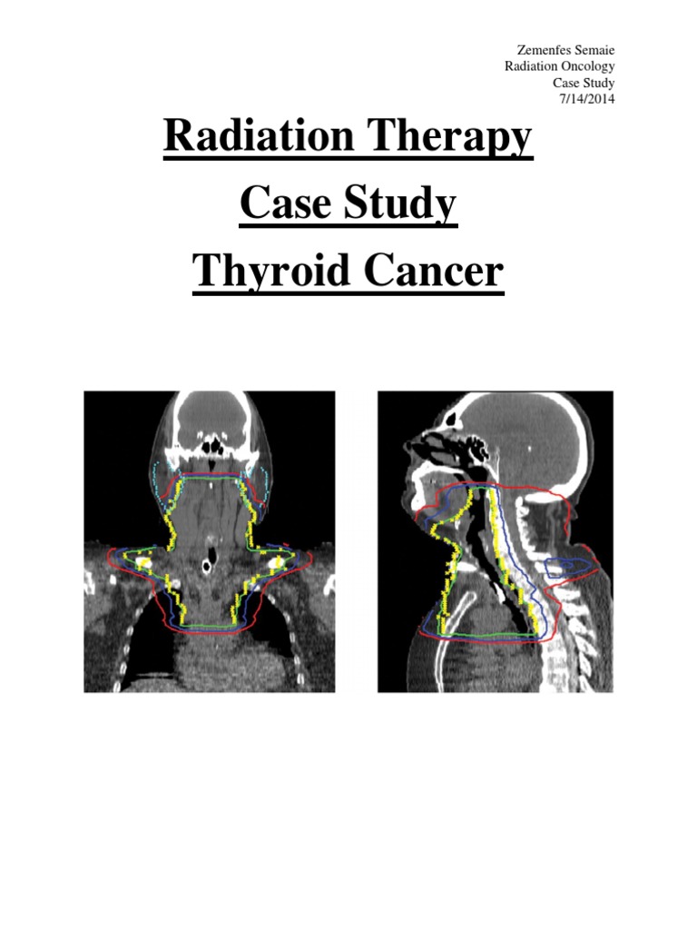 Radiotherapy case study 06 picture