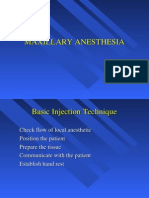 Maxillary Anesthesia -1