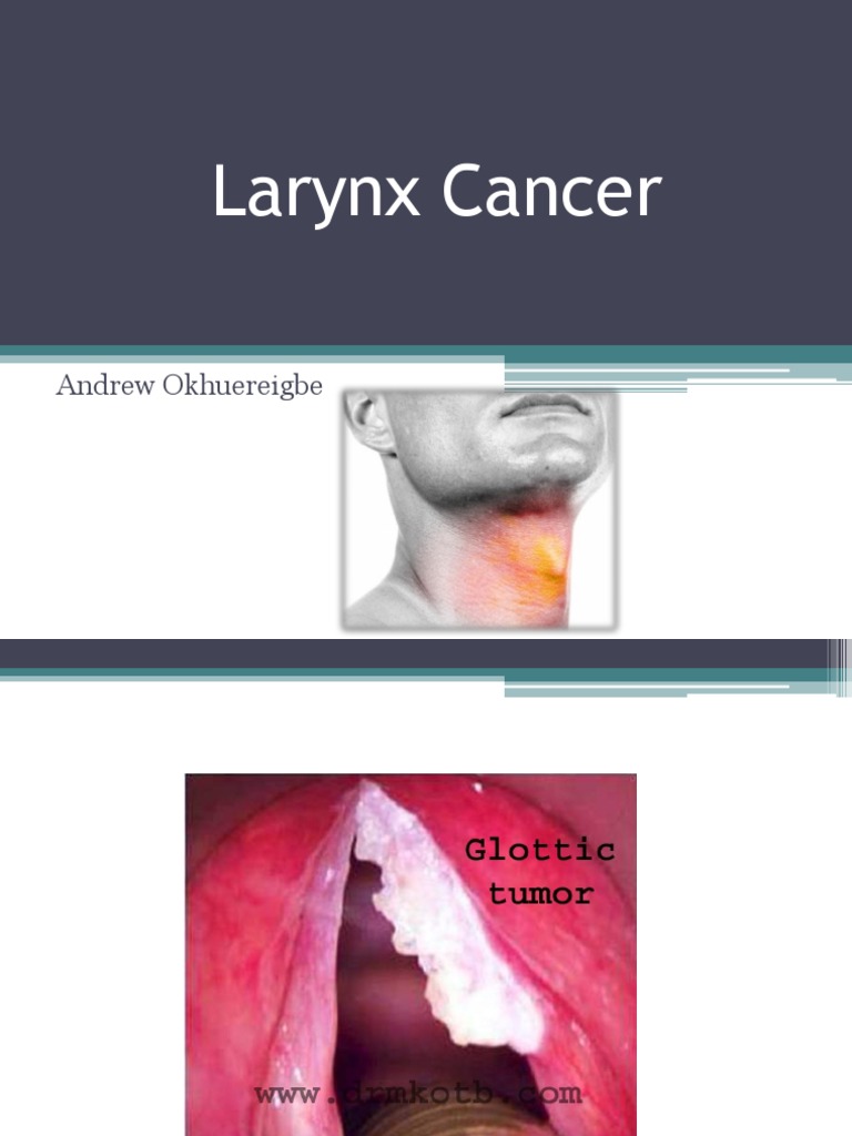 Larynx Cancer Case Study Andrew PDF Neck Radiation Therapy