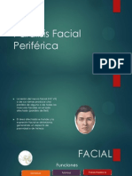 Paralisis Facial Periférica