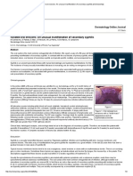 Isolated Oral Erosions - An Unusual Manifestation of Secondary Syphilis (EScholarship)