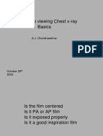 Approach To Viewing Chest X-Ray Basics: A.J. Chandrasekhar