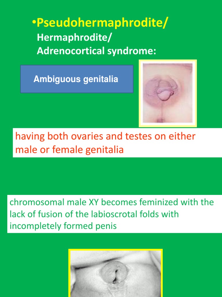 Ambiguous Genitalia 5 | PDF | Intersex | Sex