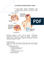 Komplikasi Ventriculoperitoneal Shunt