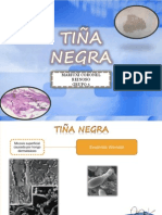 tiña