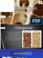 Osteoporosis - Nutricion