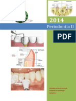 Ebook Periodontia II