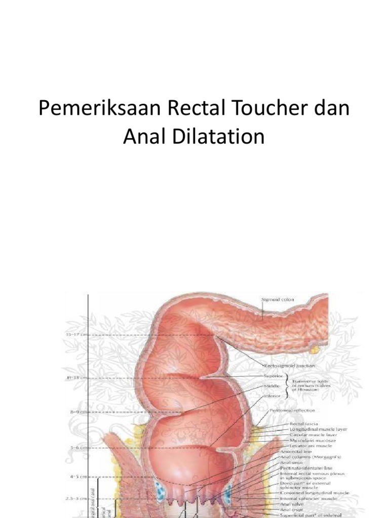 Pemeriksaan dan Anal Dilatasi Anus | PDF
