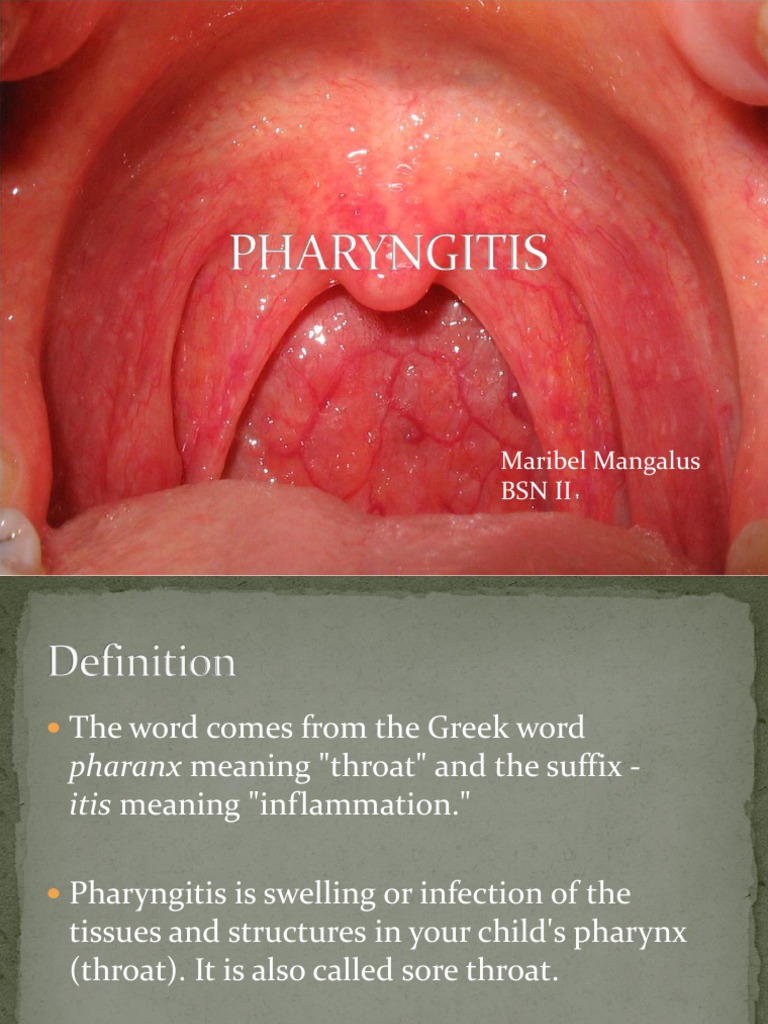 Understanding Pharyngitis and Tonsillitis | PDF | Medical Specialties ...