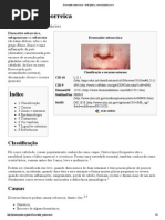 Dermatite Seborreica – Wikipédia, A Enciclopédia Livre
