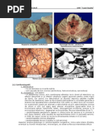 05 Moartesubita 2