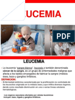 Leucemia