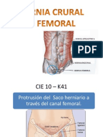 Hernia Crural