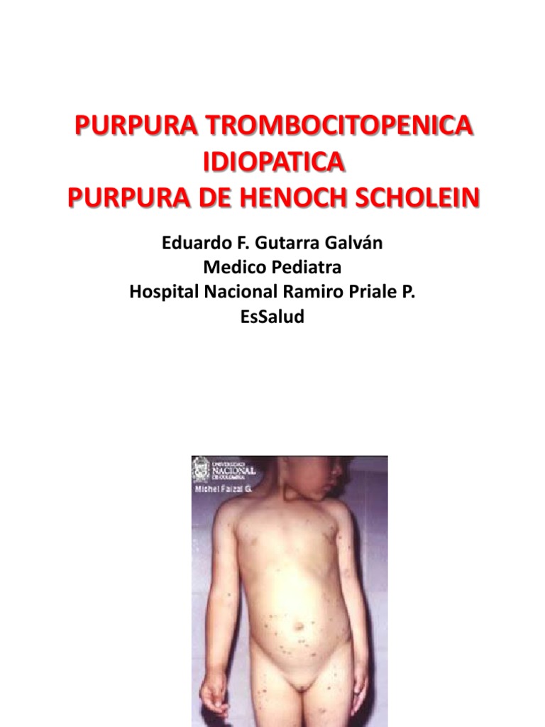 Purpura Trombocitopenica Idiopatica PDF Droga antiinflamatoria libre de esteroides Plaqueta