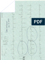 Ecg Com Defeito