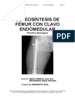 Osteosíntesis de Fémur Con Clavo Endomedular