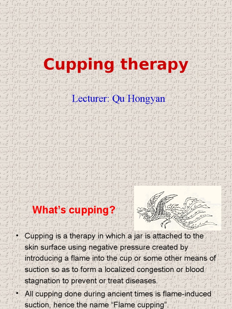 Cupping Therapy Chinese Clinical Medicine Medicine