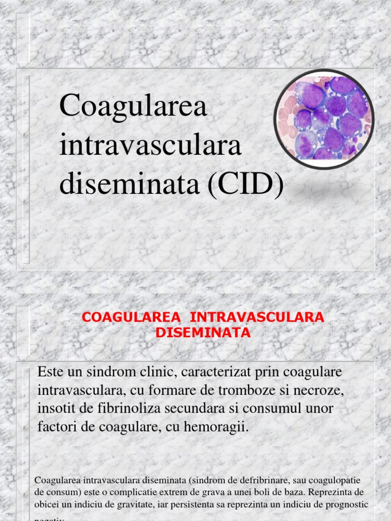 cid | PDF