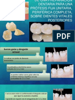 Dentaria para Protesisi Fija