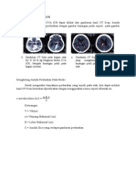 Menghitung Perdarahan CVA ICH