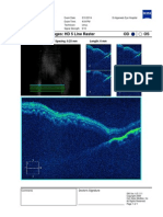 OS OD High Definition Images: HD 5 Line Raster: Scan Angle: 0° Spacing: 0.25 MM Length: 6 MM