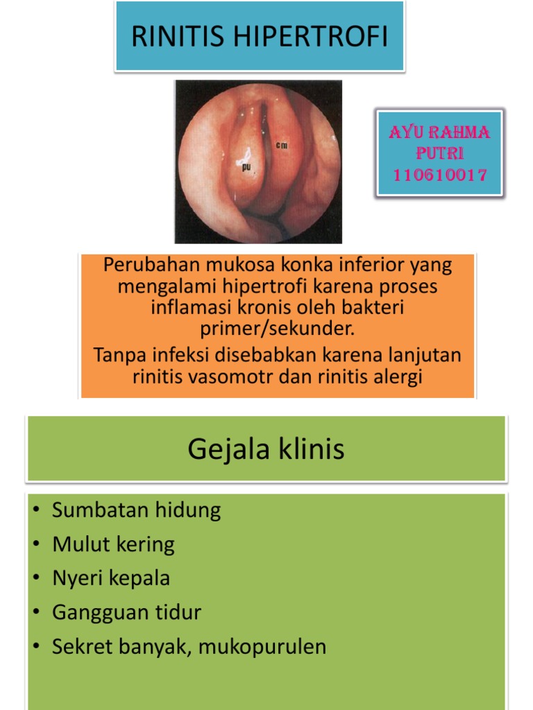 Rinitis: Gejala, Diagnosis, dan Terapi | PDF | Kesehatan Holistik ...
