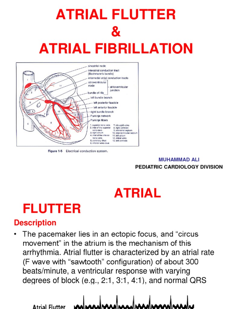 A Comparison of Atrial Flutter and Atrial Fibrillation: Causes ...