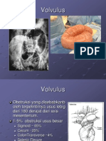 Volvulus