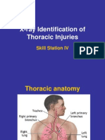 X-Ray Identification of Thoracic Injuries..1