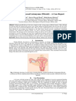 Uterine Sub Mucosal Leiomyoma (Fibroid) - A Case Report