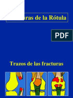 04 - Fracturas de La Rotula, Traumatologia.