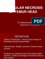 Avascular Necrosis of Femur head DR Akbar