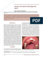 Compound Odontoma Associated With Impacted Teeth: A Case Report