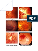 Labelled Fundus Pictures