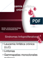 Leucemia Linfática Crónica