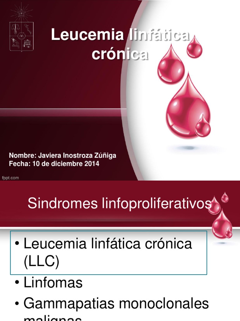 Leucemia linfática crónica Leukemia Clinical Medicine