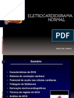 Apresentação 1 ECG