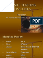 BST Episkeritis