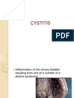 Cystitis