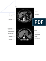 Anatomi CT Scan Abdomen