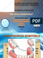 Protesis Parcial Removible