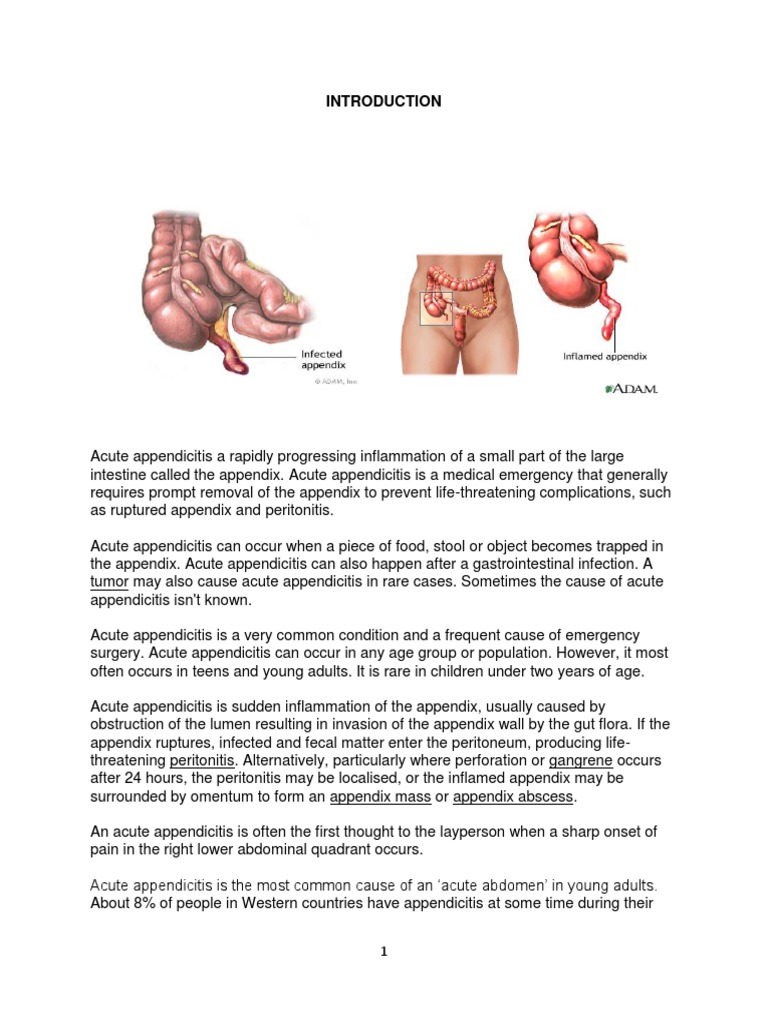 Acute Appendicitis | PDF
