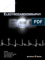 ECG Analysis