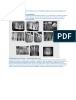 Radiografii Intraorale