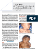 Congenital Muscular Torticollis