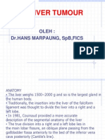 Hepatocellular Carcinoma 3