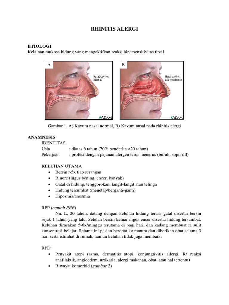 Klasifikasi dan Penanganan Rhinitis Alergi | PDF | Kesehatan Holistik