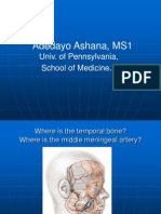 Epidural Hematoma