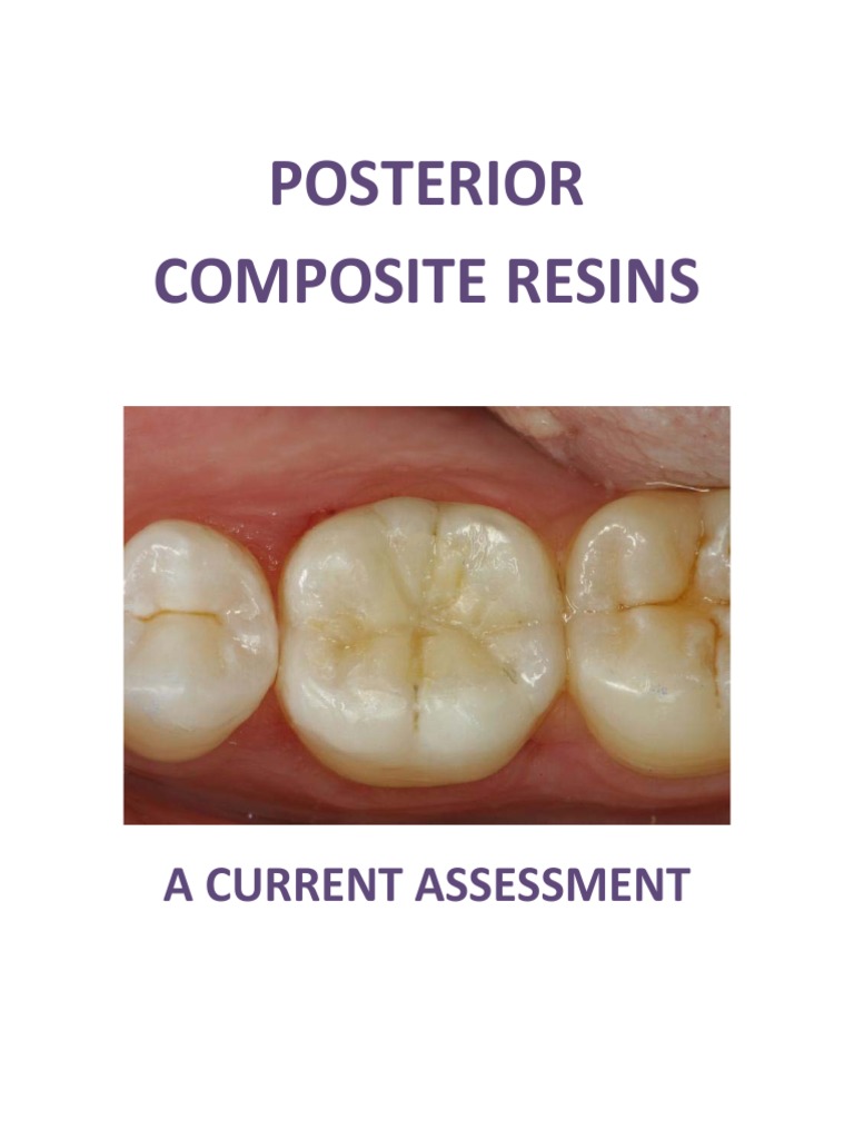 Posterior Composite Resins a Current Assessment Dental Composite Mouth